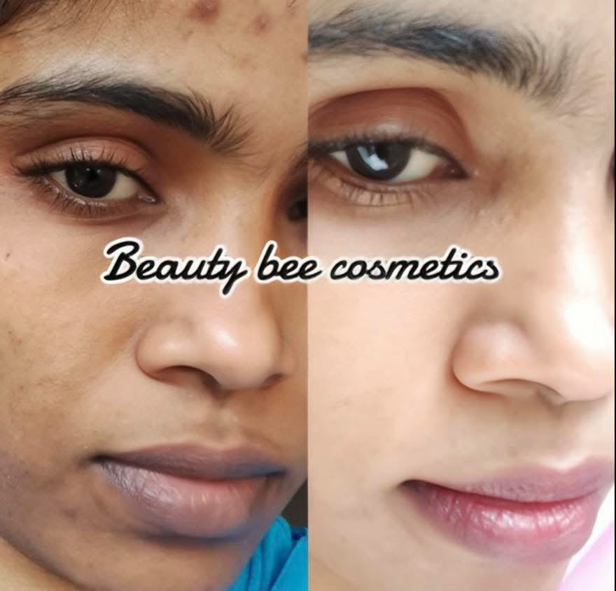 Face Care Result
